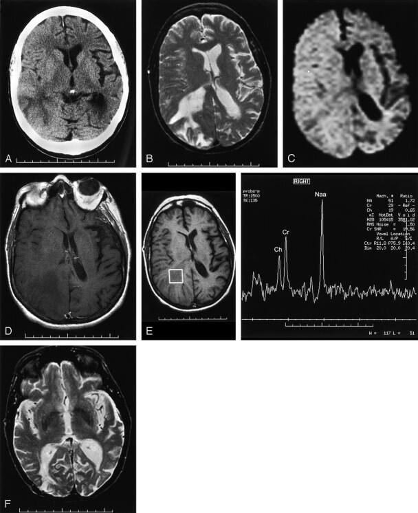 Fig 2.