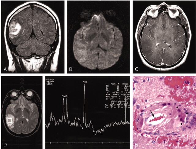 Fig 1.