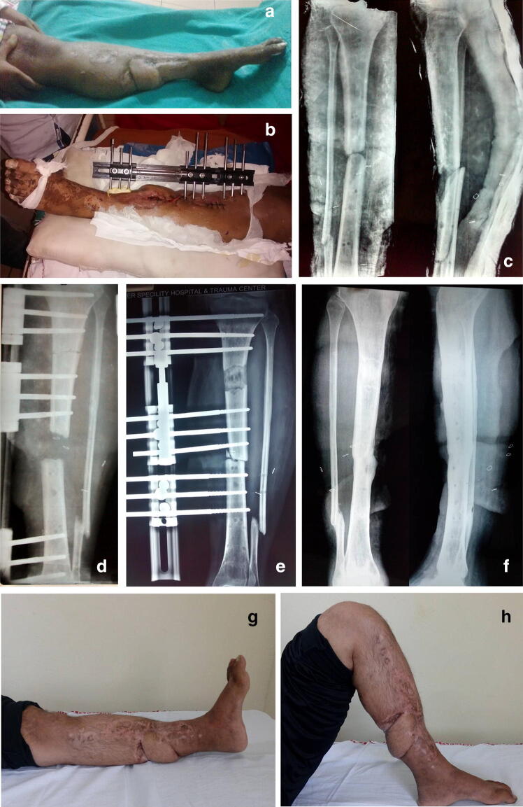 Fig. 2