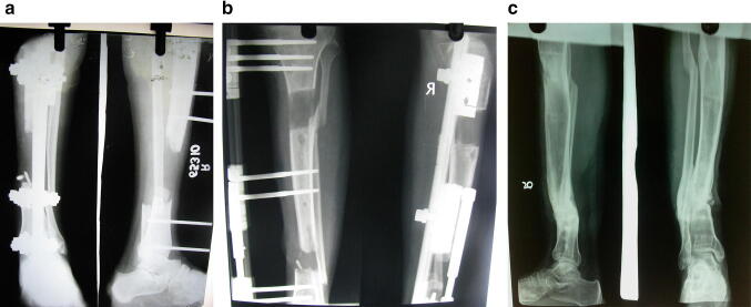 Fig. 3