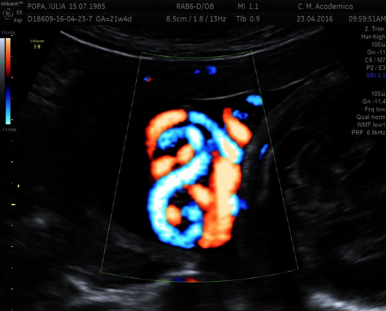Fig. 2