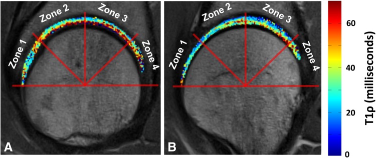 Fig. 2A–B