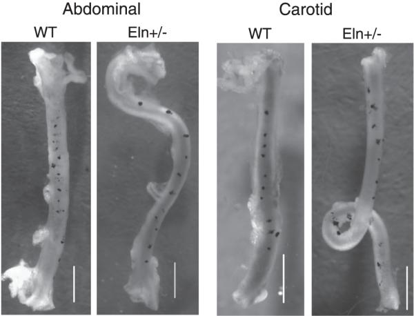 FIG. 10