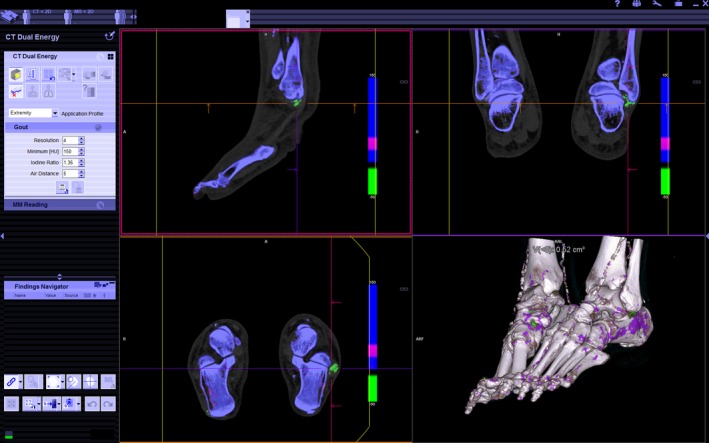 Figure 2