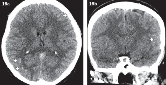 Fig. 16