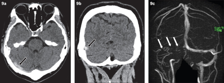 Fig. 9