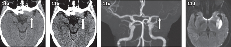 Fig. 11