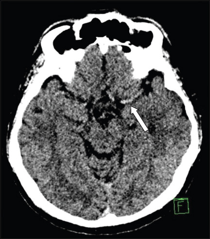 Fig. 13