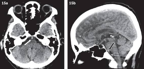 Fig. 15