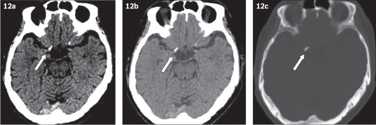 Fig. 12