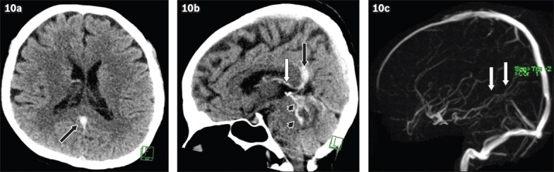 Fig. 10