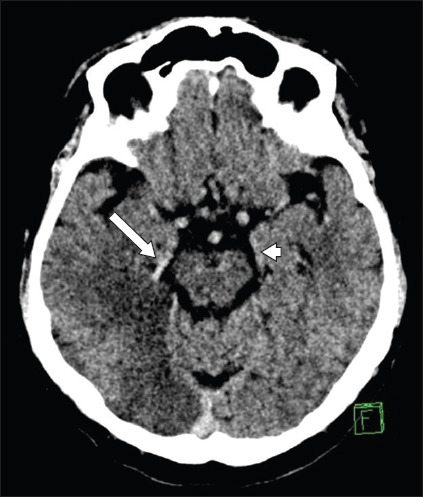 Fig. 5