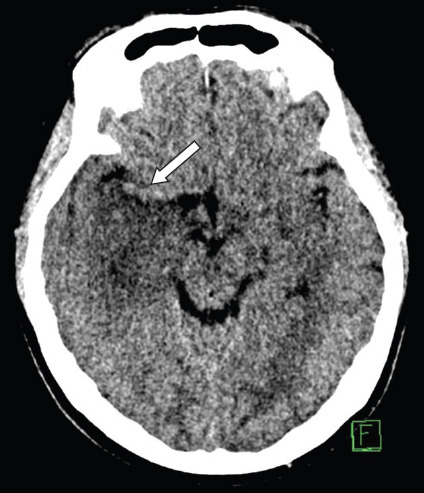 Fig. 14