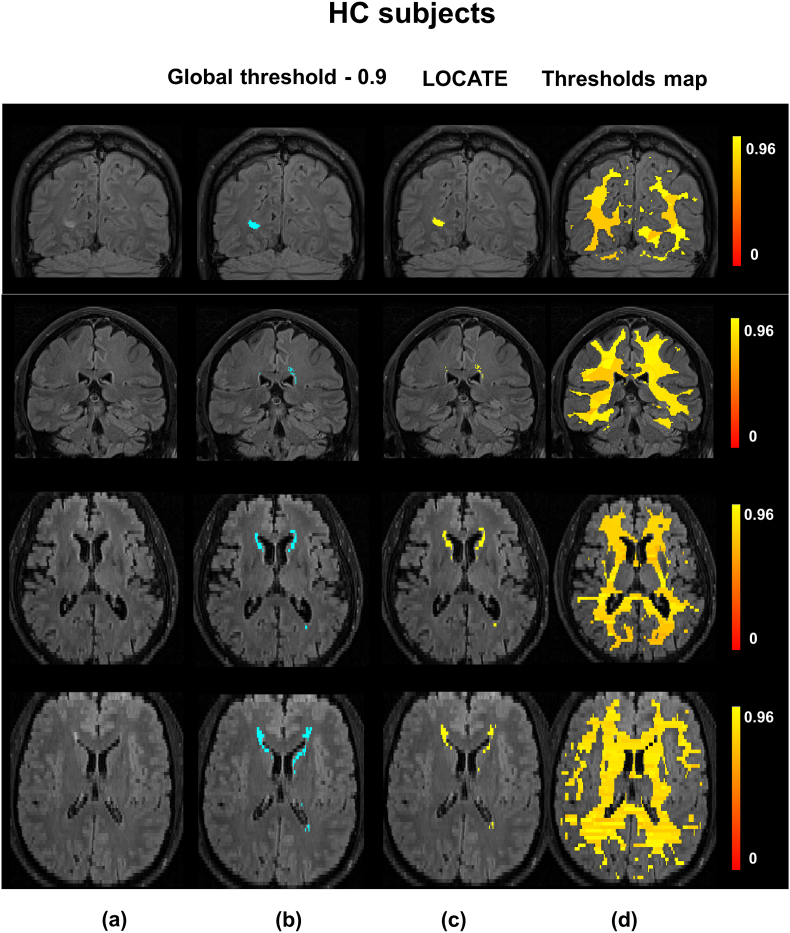 Fig. 13