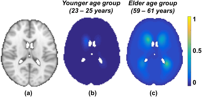 Fig. 2