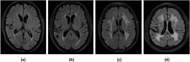 Fig. 3