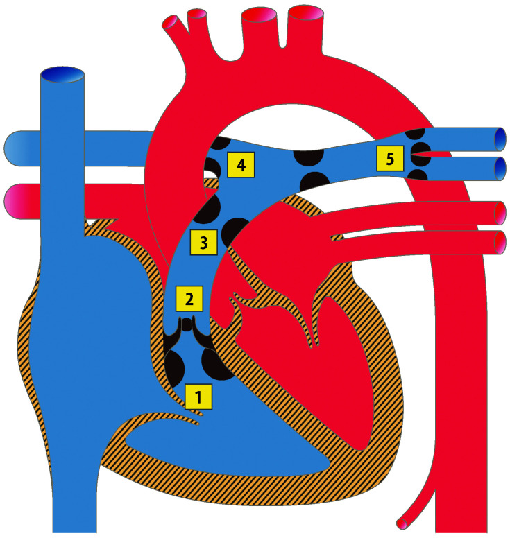 graphic file with name 978-3-662-57295-5_20_Fig9_Print.jpg