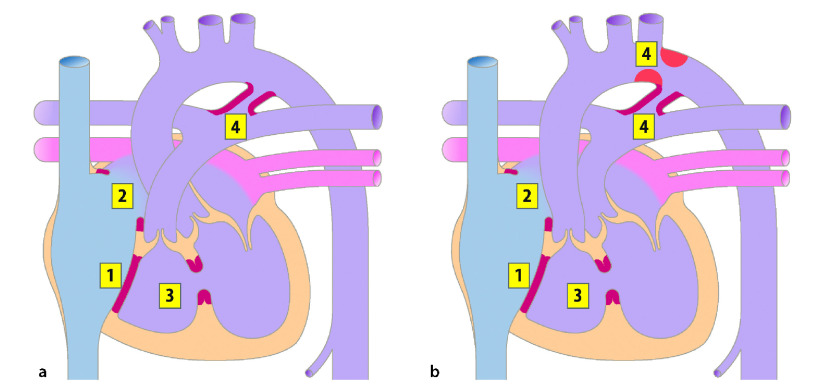 graphic file with name 978-3-662-57295-5_20_Fig16_Print.jpg