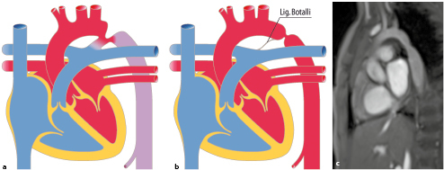 graphic file with name 978-3-662-57295-5_20_Fig7_HTML.jpg