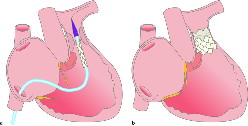 graphic file with name 978-3-662-57295-5_20_Fig12_Print.jpg