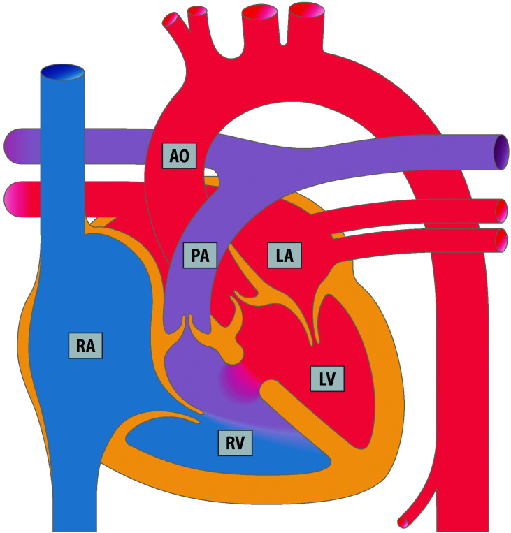 graphic file with name 978-3-662-57295-5_20_Fig2_Print.jpg