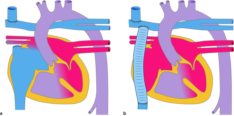 graphic file with name 978-3-662-57295-5_20_Fig17_Print.jpg