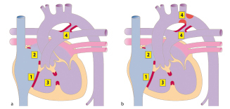 graphic file with name 978-3-662-57295-5_20_Fig16_HTML.jpg