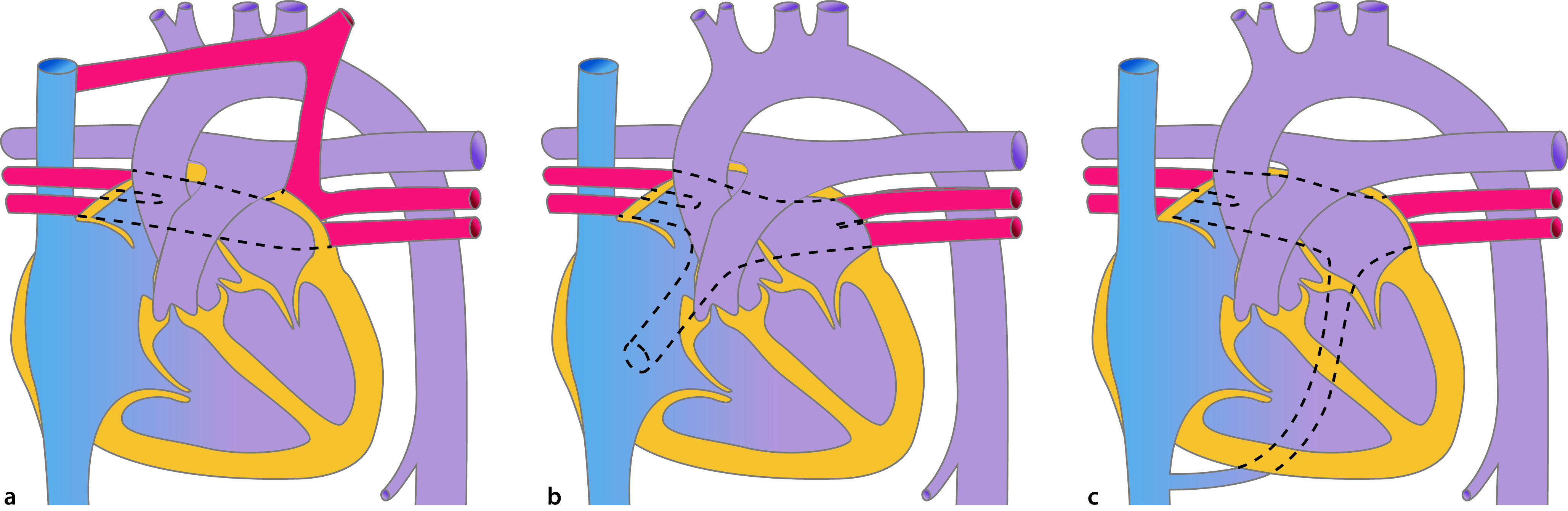 graphic file with name 978-3-662-57295-5_20_Fig14_Print.jpg