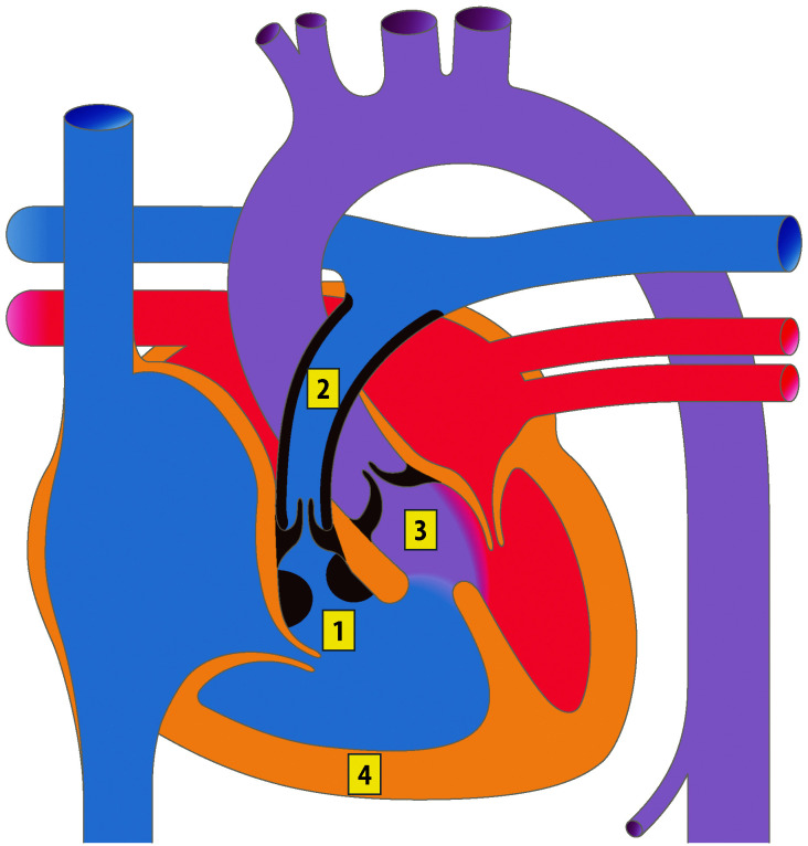 graphic file with name 978-3-662-57295-5_20_Fig10_Print.jpg