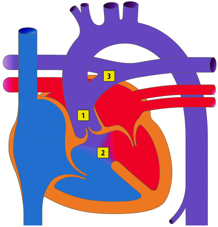 graphic file with name 978-3-662-57295-5_20_Fig15_Print.jpg