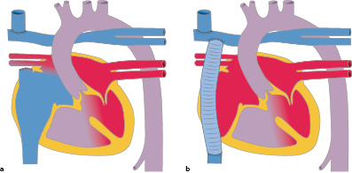 graphic file with name 978-3-662-57295-5_20_Fig17_HTML.jpg