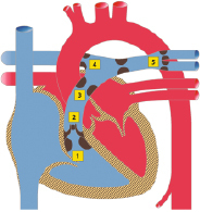 graphic file with name 978-3-662-57295-5_20_Fig9_HTML.jpg