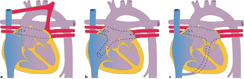 graphic file with name 978-3-662-57295-5_20_Fig14_HTML.jpg