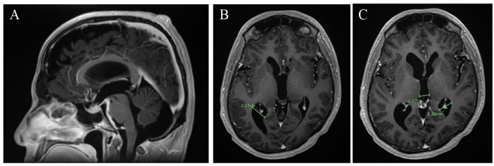 Figure 2.