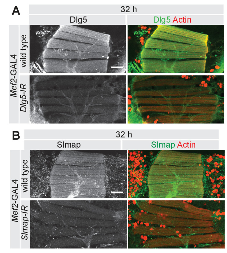 Figure 2—figure supplement 1.