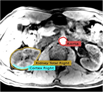 Fig. 2