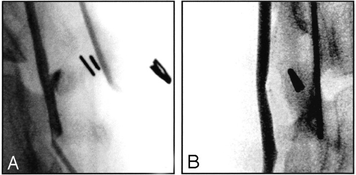 Fig 3.