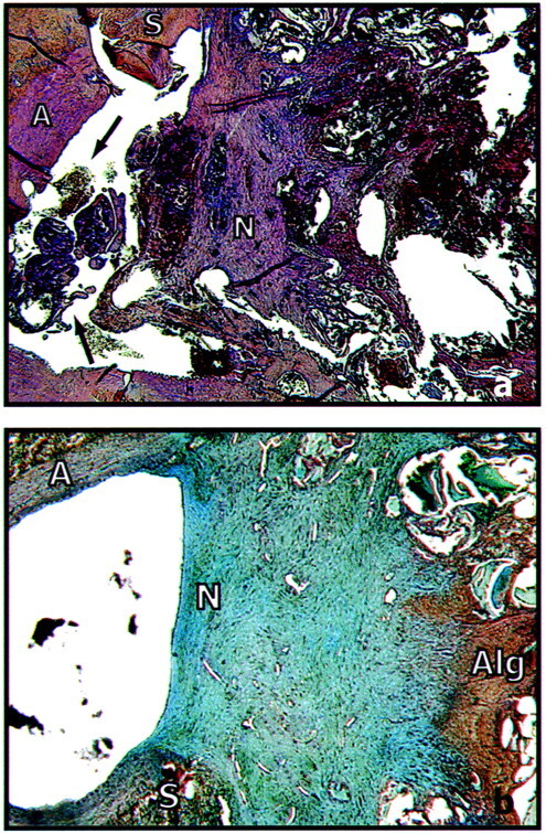 Fig 5.