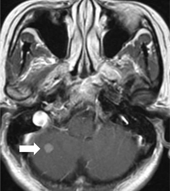 Figure 5c: