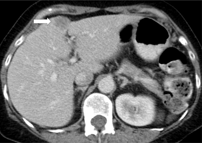 Figure 7a: