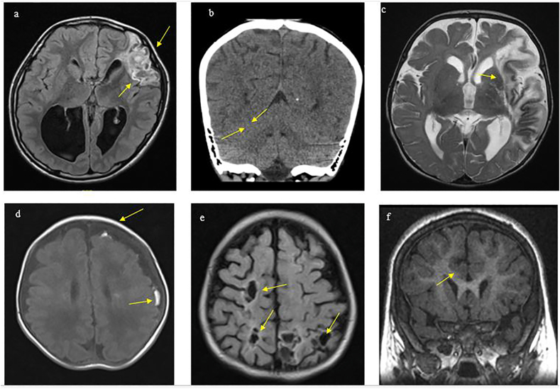 Fig. 1