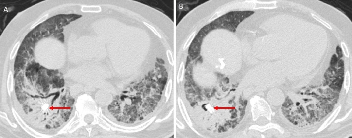 Fig. 4 –