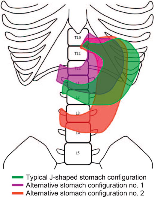 FIG. 1