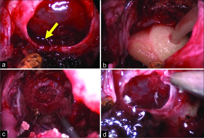 Figure 1: