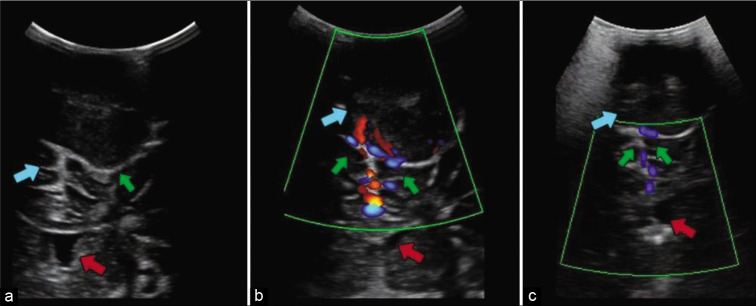 Figure 2: