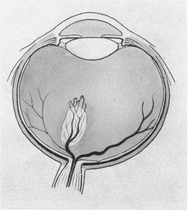 Fig. 1. B