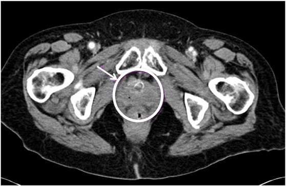 Fig. 1