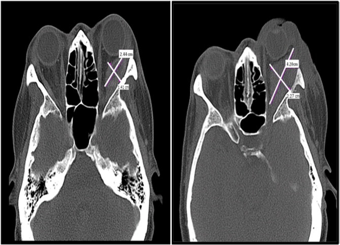 Fig. 3