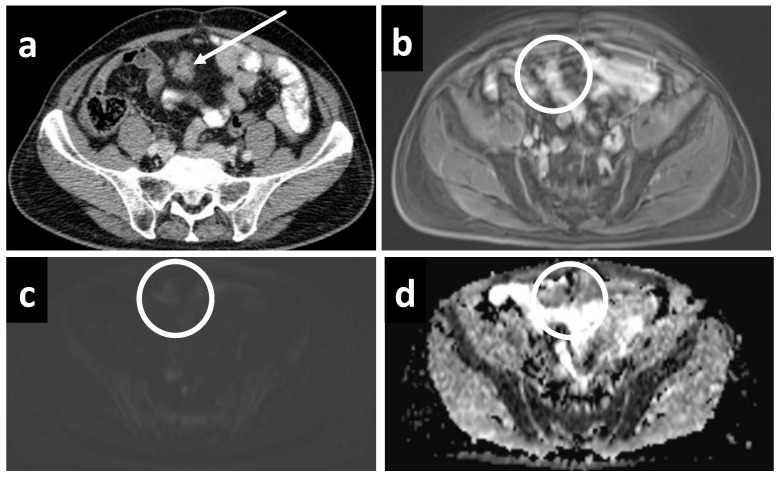 Figure 10