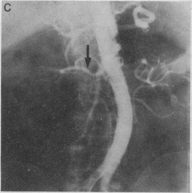 FIG. 1C